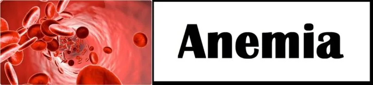 Anemia